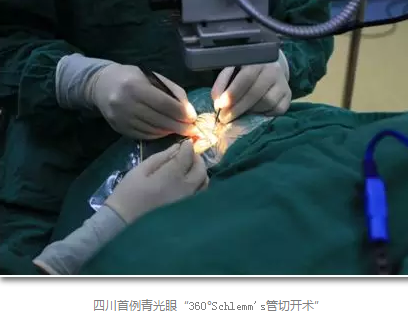 成都8868体育官方网站(官方)登录入口已经开展的青光眼手术有：引流阀 (钉)植入手术(2015年以来已200多 )，360°Schlemm's管切开术，激光CO2 辅助巩膜深层切除术，小梁切除术青(光眼)白(内障)联合手术。还有虹膜周切术、前房成形术、 虹膜复位术，睫状体冷冻术，小梁切开术和前房穿刺术等6.png
