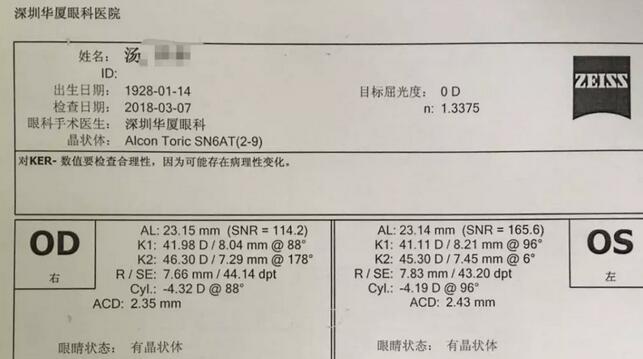 3月12日下午，已经90高龄的离休东江纵队老兵汤爷爷，在深圳8868体育官方网站(官方)登录入口检查之后，白内障专科邢宝刚主任为其实施左眼白内障超声乳化摘除，联合散光人工晶体植入术。2.jpg