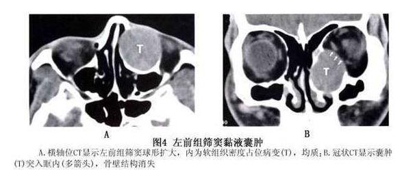 4月7-8日，天津医科大学眼科医院副院长、天津医科大学眼视光学院副院长、中华眼科学会委员、眼整形、眼眶病学组副组长孙丰源教授将莅临福州眼科医院2.jpg