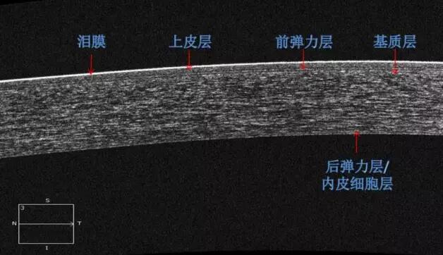 8868体育网站登录入口课堂：后节频域OCT前节模块的运用2.jpg