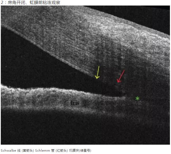8868体育网站登录入口课堂：后节频域OCT前节模块的运用12.jpg