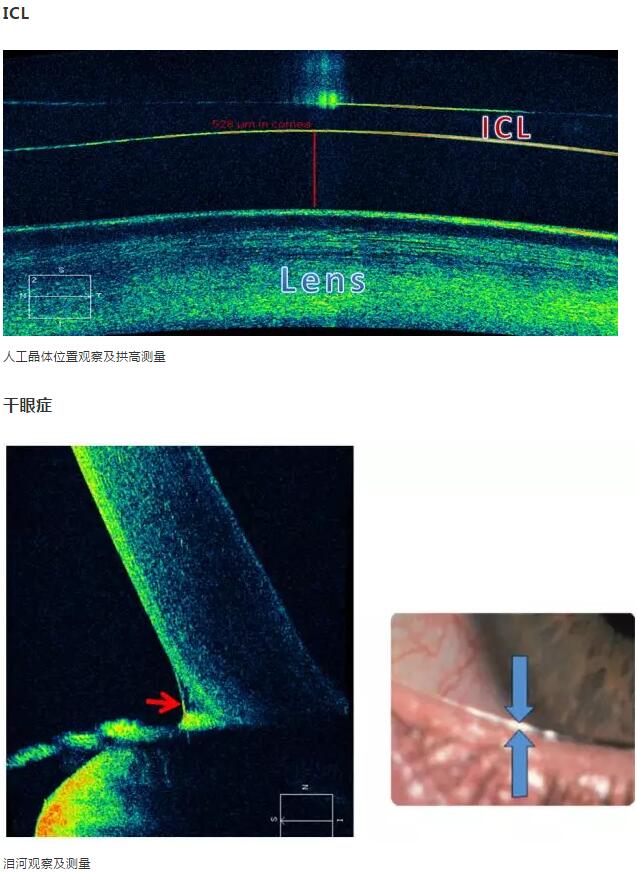 8868体育网站登录入口课堂：后节频域OCT前节模块的运用15.jpg