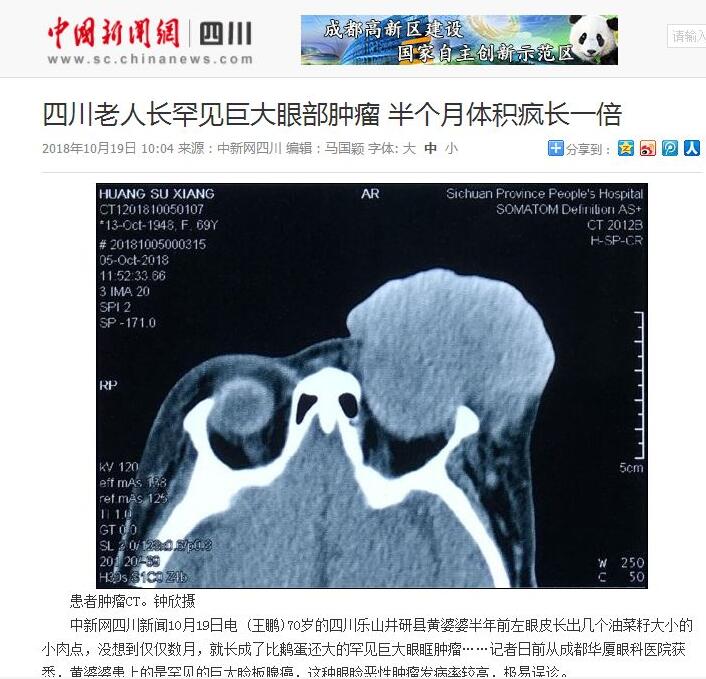 媒体看8868体育网站登录入口之成都8868体育官方网站(官方)登录入口2018年新闻媒体报道集锦13.jpg