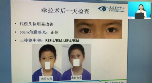 高峰论道·云端荟萃 ▏万人同步在线，30余名大咖云集“第六届8868体育网站登录入口论坛斜视与小儿眼科新技术学习班暨小儿、眼视光分论坛”7.png