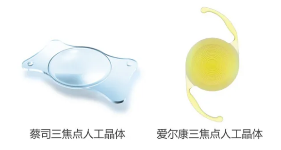 我看到了9个月亮，中国医生一招解决！“洋女婿”患白内障几近失明，在厦门眼科中心手术4.png