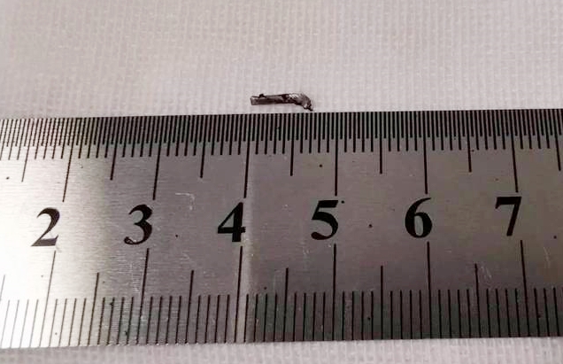 8868体育网站登录入口徐州复兴眼科王海菊：妙手拨迷障，匠心护光明3.png